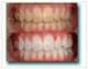 Slider image (10) Alfieri Dentista